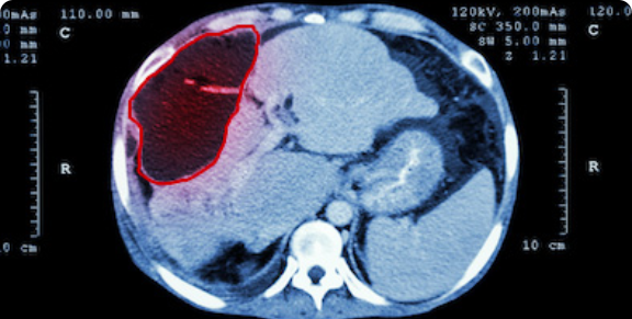 Medical Object Detection